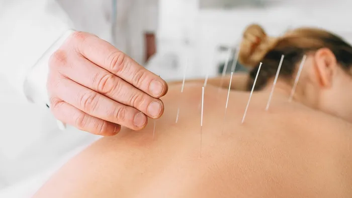 Needle Your Way to Parenthood: Can Acupuncture Boost Your Baby-Making Odds?